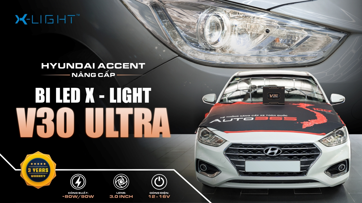 Hyundai Accent nâng cấp Bi LED X-Light V30 Ultra tại Đại lý Auto365.vn -Trụ sở chính